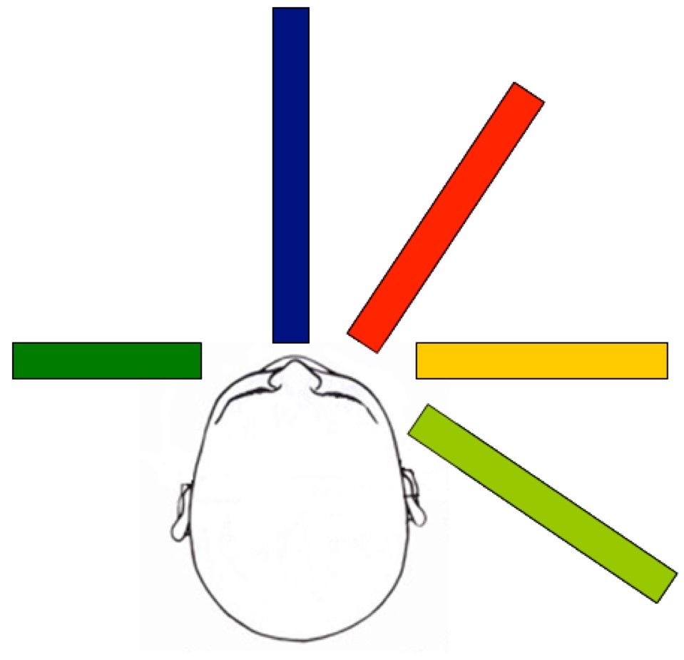 n/a